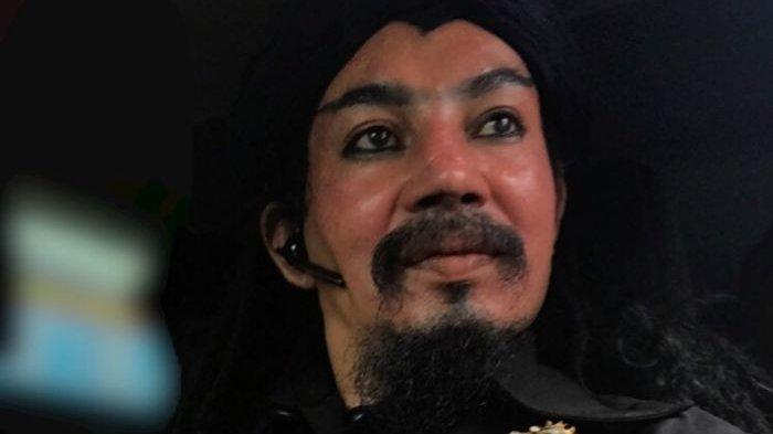 Geger! Gigi Taring Limbad Bikin Petugas Imigrasi Arab Saudi Berteriak ‘Setan’, Begini Kisahnya!